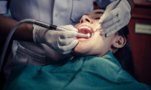 Tooth Removal in Alwar, Tooth Removal