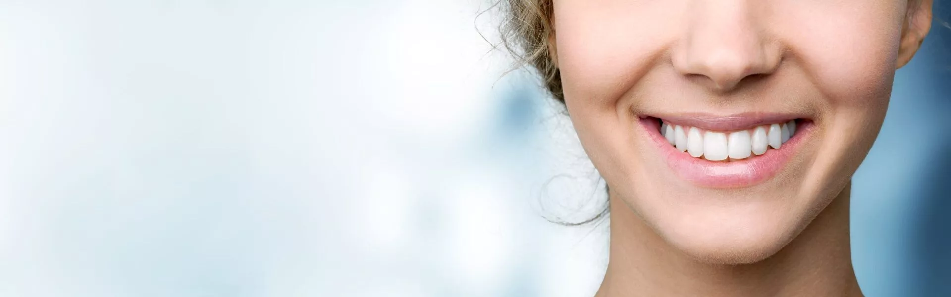 , Smile Makeover