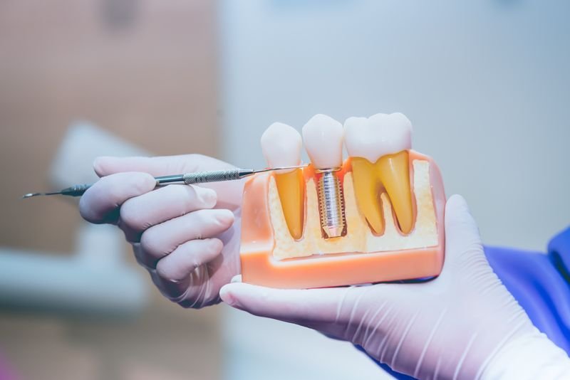 The Importance of Regular Dental Check-Ups, The Importance of Regular Dental Check-Ups: Why You Shouldn’t Skip Them