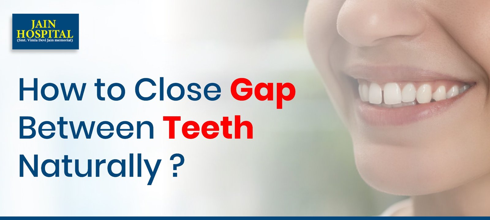 Gap Between Teeth