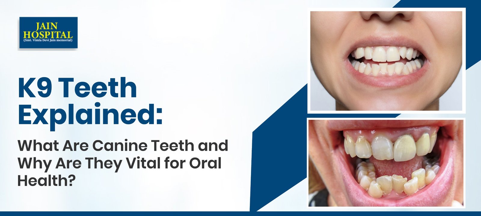 K9 Teeth, K9 Teeth Explained: What Are Canine Teeth and Why Are They Vital for Oral Health?