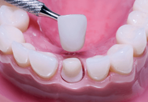 Dental Services In Alwar, Services