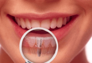 Dental Services In Alwar, Services