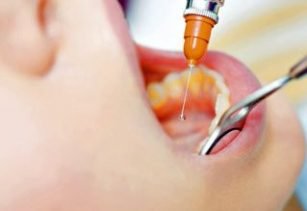 Dental Services In Alwar, Services