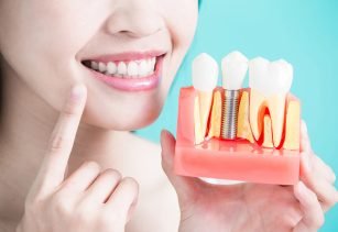 Dental Services In Alwar, Services