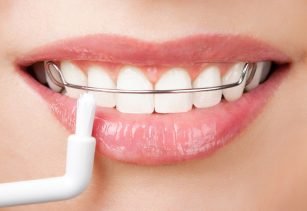 Dental Services In Alwar, Services