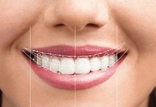 Dental Services In Alwar, Services