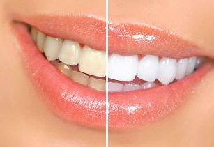 Dental Services In Alwar, Services