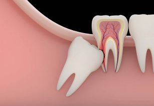 Dental Services In Alwar, Services